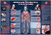 Электрифицированный стенд "Вредные привычки: алкоголизм" - fgospostavki.ru - Тула