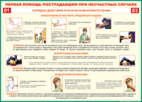 Таблица "Порядок действий при опасном кровотечении" (100х140 сантиметров, винил) - fgospostavki.ru - Тула